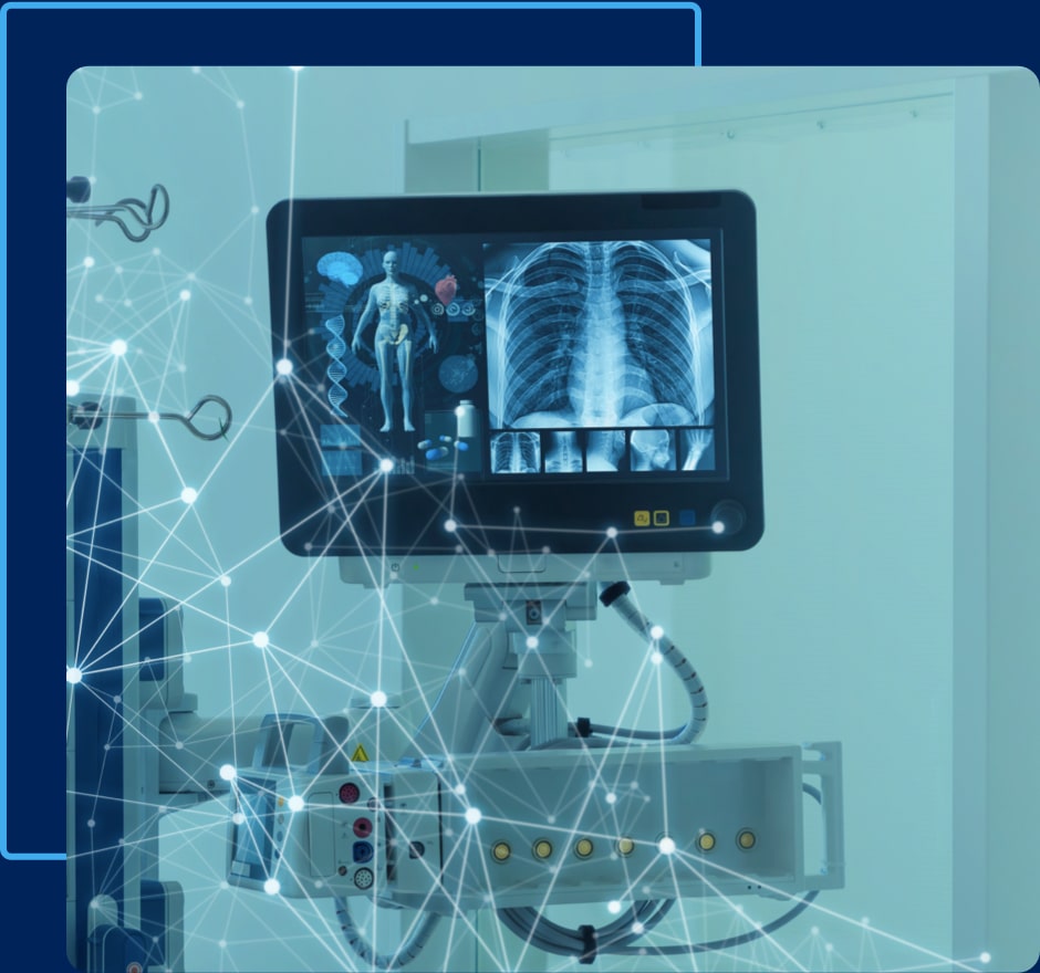 Lung X-ray scan shown on a monitor.