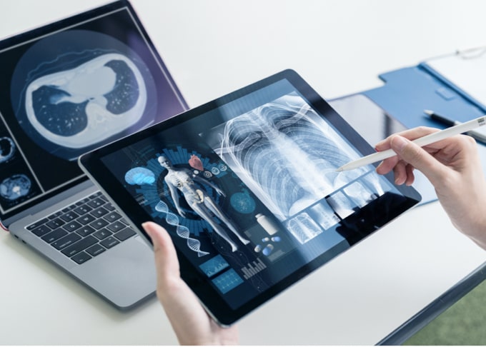 A laptop showing chest CT scan and tablet computer showing chest X-ray.